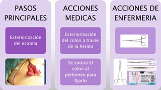 PASOS
PRINCIPALES
Exteriorización
del estoma
ACCIONES
MEDICAS
Exteriorización
del colon a través
de la herida
Se sutura el
colon al
peritoneo para
fijarlo
ACCIONES DE
ENFERMERIA
 