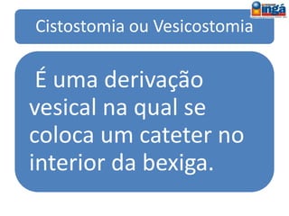 Complicações
Precoces:
• isquemia ou necrose da alça exteriorizada,
sangramento, retração, infecção, edema,
dermatite peri-estomal.
Tardias:
• estenose e obstrução, prolapso, hérnia para-
estomal, fístulas.
 