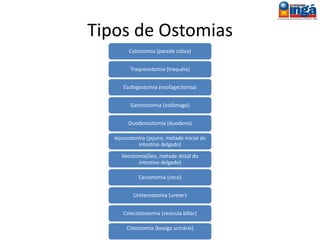 Conceito
Os estomas intestinais são feitos em alças
com mobilidade e comprimento
adequados, que facilitem sua
exteriorização através da parede
abdominal.
• Íleo,
• Cólon transverso e
• Sigmóide.
 