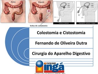 Ostomias e Cistostomia
Fernando de Oliveira Dutra
Cirurgia do Aparelho Digestivo
 