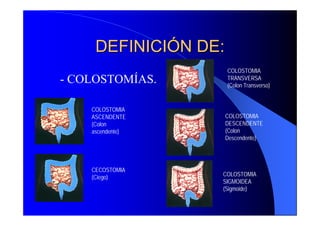 DEFINICIÓN DE:
                      COLOSTOMIA
- COLOSTOMÍAS.        TRANSVERSA
                      (Colon Transverso)


    COLOSTOMIA
    ASCENDENTE    COLOSTOMIA
    (Colon        DESCENDENTE
    ascendente)   (Colon
                  Descendente)




    CECOSTOMIA
    (Ciego)       COLOSTOMIA
                  SIGMOIDEA
                  (Sigmoide)
 