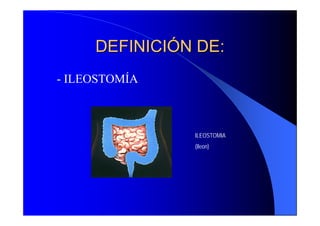 DEFINICIÓN DE:
- ILEOSTOMÍA



               ILEOSTOMIA
               (Ileon)
 