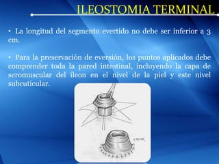 ILEOSTOMIA TERMINAL
• La longitud del segmento evertido no debe ser inferior a 3
cm.
• Para la preservación de eversión, los puntos aplicados debe
comprender toda la pared intestinal, incluyendo la capa de
seromuscular del íleon en el nivel de la piel y este nivel
subcuticular.
 