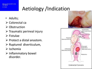 Colostomy | PPSX