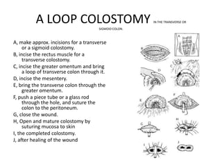 A LOOP COLOSTOMY             SIGMOID COLON.
                                                        IN THE TRANSVERSE OR




A, make approx. incisions for a transverse
     or a sigmoid colostomy.
B, incise the rectus muscle for a
     transverse colostomy.
C, incise the greater omentum and bring
     a loop of transverse colon through it.
D, incise the mesentery.
E, bring the transverse colon through the
     greater omentum.
F, push a piece tube or a glass rod
     through the hole, and suture the
     colon to the peritoneum.
G, close the wound.
H, Open and mature colostomy by
     suturing mucosa to skin
I, the completed colostomy.
J, after healing of the wound
 