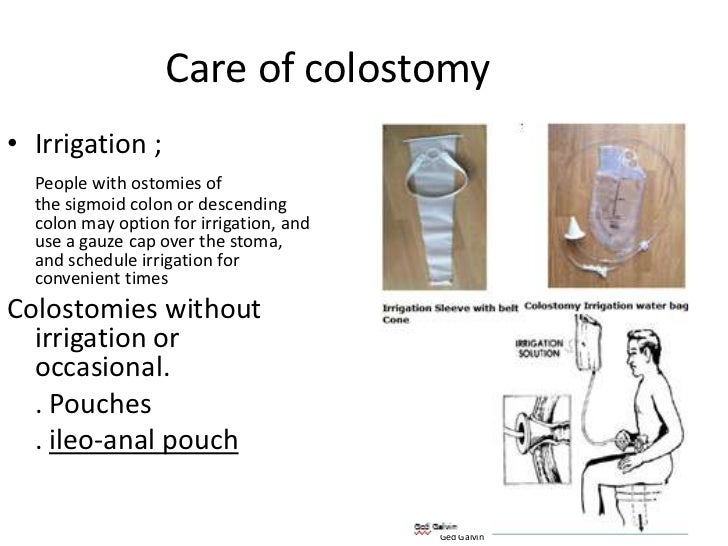 Colostomy