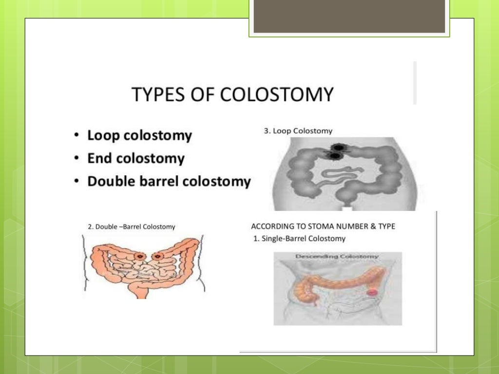 Colostomy