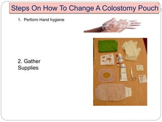 Steps On How To Change A Colostomy Pouch :
1. Perform Hand hygiene
2. Gather
Supplies
 