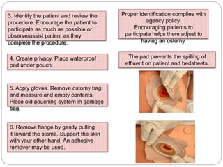3. Identify the patient and review the
procedure. Encourage the patient to
participate as much as possible or
observe/assist patient as they
complete the procedure.
Proper identification complies with
agency policy.
Encouraging patients to
participate helps them adjust to
having an ostomy.
4. Create privacy. Place waterproof
pad under pouch.
The pad prevents the spilling of
effluent on patient and bedsheets.
5. Apply gloves. Remove ostomy bag,
and measure and empty contents.
Place old pouching system in garbage
bag.
6. Remove flange by gently pulling
it toward the stoma. Support the skin
with your other hand. An adhesive
remover may be used.
 