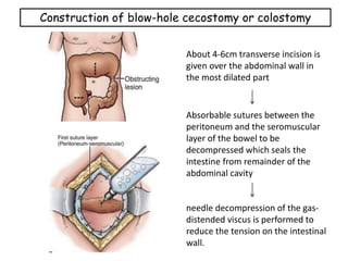 Colostomy -Large intestine | PPT