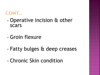 • Operative incision & other
scars
• Groin flexure
• Fatty bulges & deep creases
• Chronic Skin condition
 