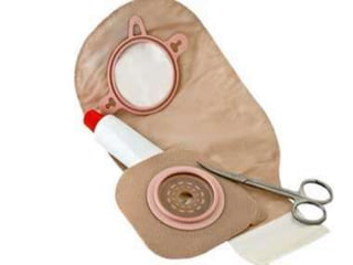 PROCEDURE
• Measure the stoma
using measuring guide.
• Trace same circle
behind the skin barrier,
using scissors, cut an
opening 1/16 to 1/8
inch larger than stoma
before removing the
wrapper over adhesive
part.
• Put skin barrier & pouch
over the stoma, &
gently press on to the
skin, for 1-2 min.
RATIONALE
• Ensure accuracy in
determining correct
pouch size needed.
• -do-
• To prevent irritation to
skin.
 