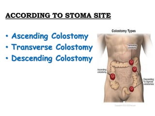 ACCORDING TO STOMA SITE
• Ascending Colostomy
• Transverse Colostomy
• Descending Colostomy
 