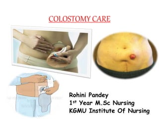 COLOSTOMY CARE
Rohini Pandey
1st Year M.Sc Nursing
KGMU Institute Of Nursing
 