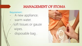 MANAGEMENT OF STOMA
Requirement :
- A new appliance.
- warm water.
- soft tissues or gauze
wipes.
- disposable bag .
 