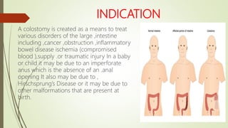 INDICATION
A colostomy is created as a means to treat
various disorders of the large ,intestine
including ,cancer ,obstruction ,inflammatory
bowel disease ischemia (compromised
blood ),supply .or traumatic injury In a baby
or child it may be due to an imperforate
anus which is the absence of an .anal
opening It also may be due to ,
Hirschsprung’s Disease or it may be due to
other malformations that are present at
birth.
 