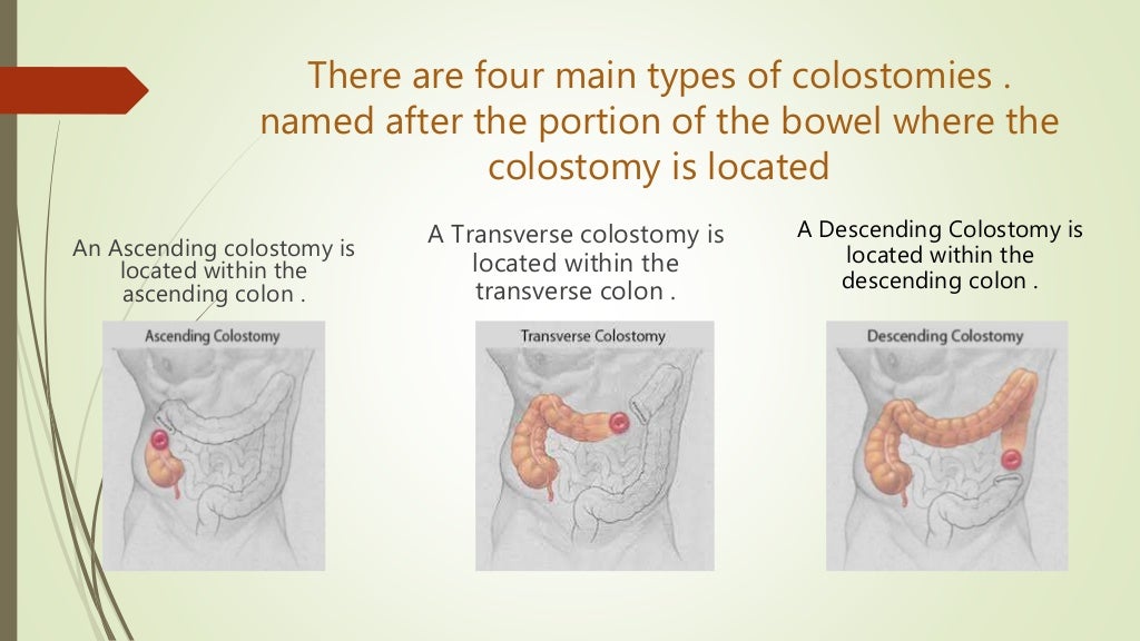 Colostomy care