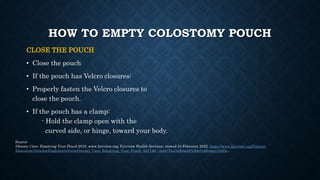 HOW TO EMPTY COLOSTOMY POUCH
CLOSE THE POUCH
• Close the pouch
• If the pouch has Velcro closures:
• Properly fasten the V...