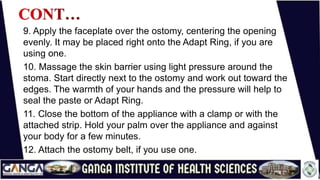 9. Apply the faceplate over the ostomy, centering the opening
evenly. It may be placed right onto the Adapt Ring, if you are
using one.
10. Massage the skin barrier using light pressure around the
stoma. Start directly next to the ostomy and work out toward the
edges. The warmth of your hands and the pressure will help to
seal the paste or Adapt Ring.
11. Close the bottom of the appliance with a clamp or with the
attached strip. Hold your palm over the appliance and against
your body for a few minutes.
12. Attach the ostomy belt, if you use one.
 