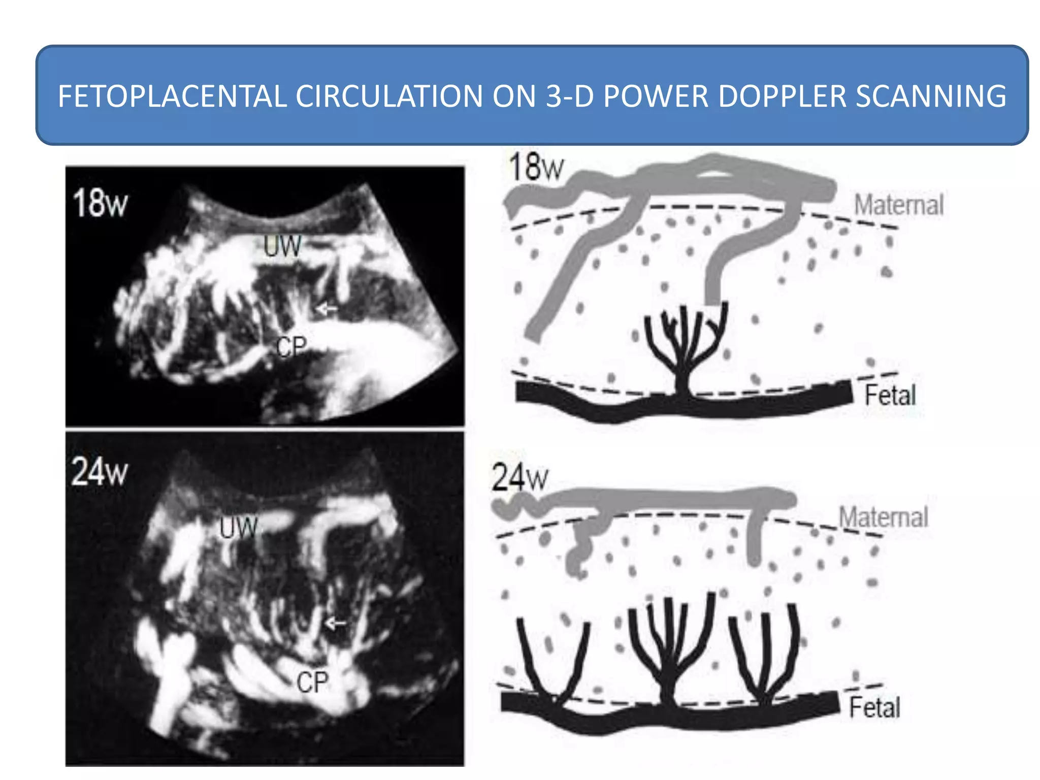 FETOPLACENTAL CIRCULATION ON 3-D POWER DOPPLER SCANNING
 