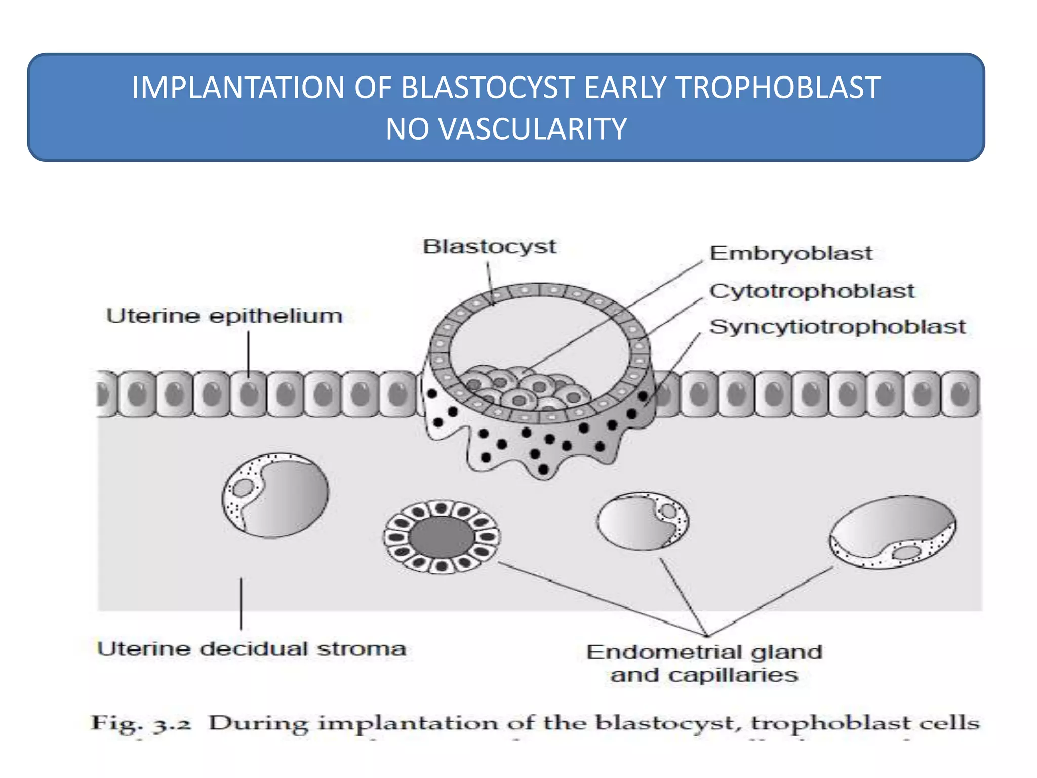 IMPLANTATION OF BLASTOCYST EARLY TROPHOBLAST
               NO VASCULARITY
 