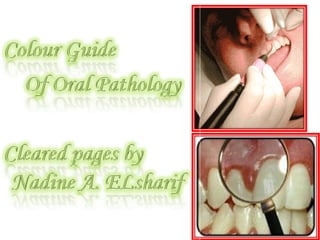Colour guide of oral pathology