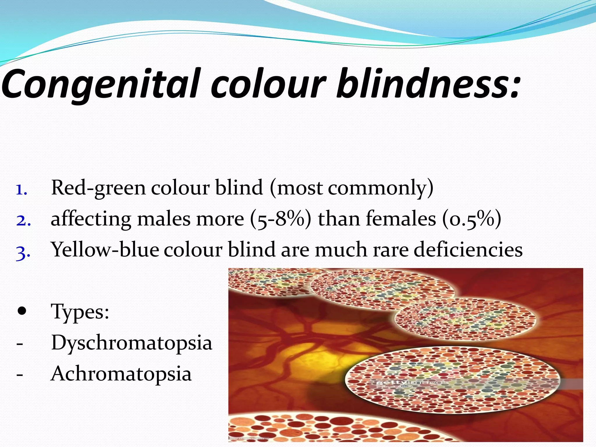 Congenital colour blindness:
1. Red-green colour blind (most commonly)
2. affecting males more (5-8%) than females (0.5%)
3. Yellow-blue colour blind are much rare deficiencies
 Types:
- Dyschromatopsia
- Achromatopsia
 