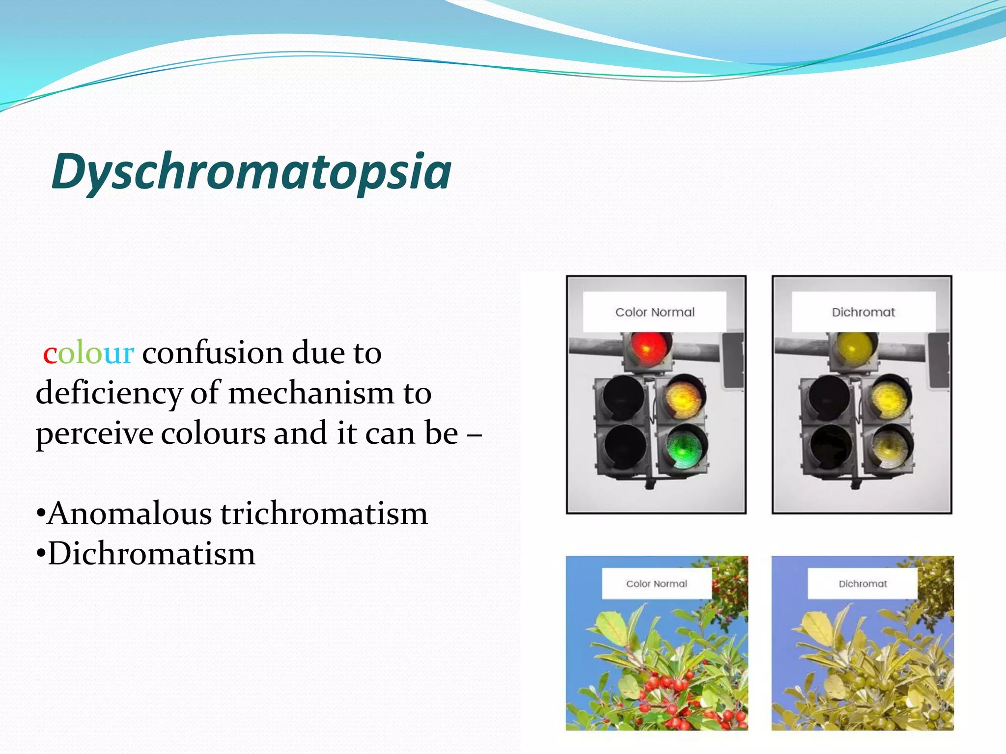 Dyschromatopsia
colour confusion due to
deficiency of mechanism to
perceive colours and it can be –
•Anomalous trichromatism
•Dichromatism
 