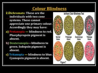 Colour Blindness
2.Dichromats: These are the
individuals with two cone
systems. These cannot
appreciate one primary colour.
Accordingly they may have:
a) Protanopia — blindness to red.
Phorphyropsin pigment is
absent.
b) Deuteranopia—blindness to
green. lodopsin pigment is
absent.
c) Tritanopia — blindness to blue.
Cyanopsin pigment is absent.
 