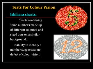 Tests For Colour Vision
Ishihara charts:
Charts containing
some numbers made up
of different coloured and
sized dots on a similar
background.
Inability to identity a
number suggests some
defect of colour vision.
 