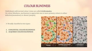 Colour vision & colour blindness | PPTX