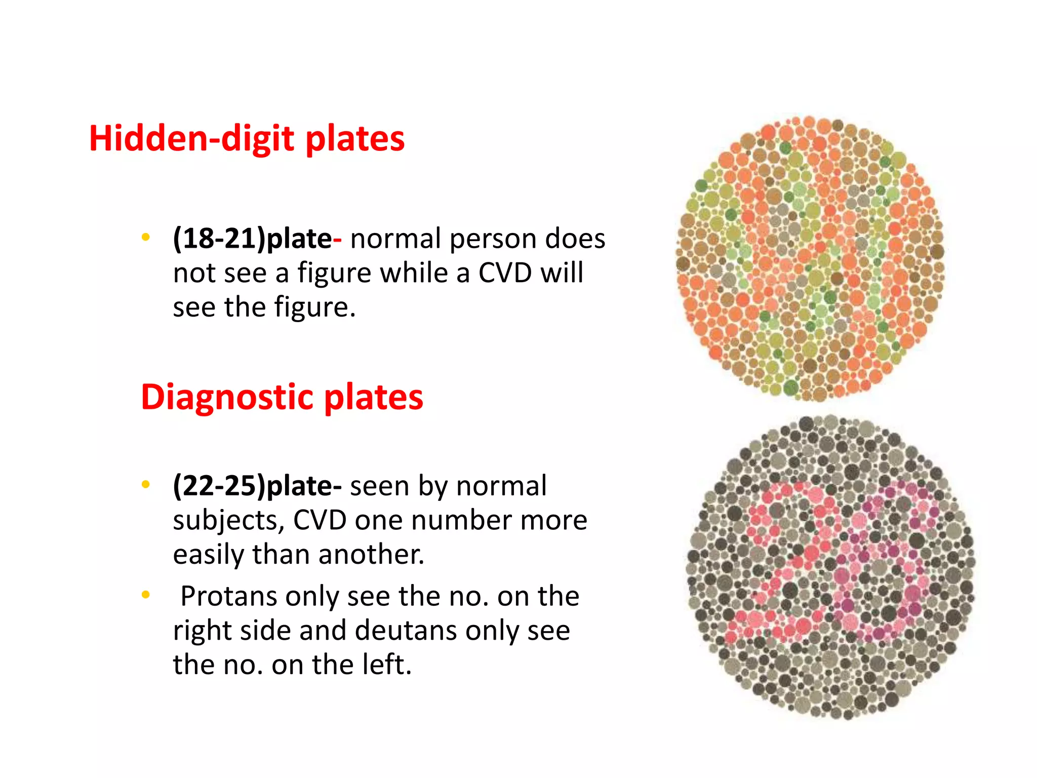 Hardy Randy Rittler COLOUR VISION & LACRIMAL TESTS---13.pptx