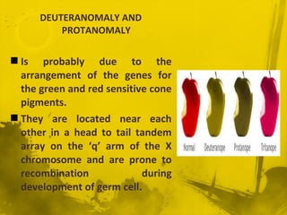 Protanomaly Example Colour vision | PPT