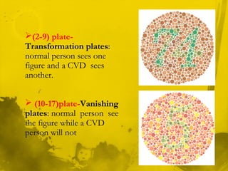 (2-9) plate-
Transformation plates:
normal person sees one
figure and a CVD sees
another.
 (10-17)plate-Vanishing
plates: normal person see
the figure while a CVD
person will not
 
