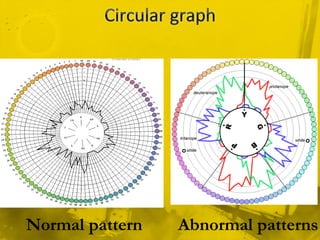 Normal pattern Abnormal patterns
 