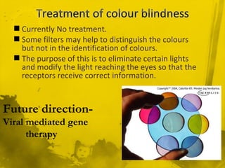  Currently No treatment.
 Some filters may help to distinguish the colours
but not in the identification of colours.
 The purpose of this is to eliminate certain lights
and modify the light reaching the eyes so that the
receptors receive correct information.
Future direction-
Viral mediated gene
therapy
 