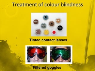 Tinted contact lenses
Filtered goggles
 