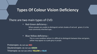 Vison Def Colour Vison Deficency (CVD) | PPTX