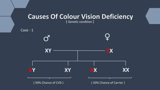 Colour Vison Deficency (CVD) | PPTX
