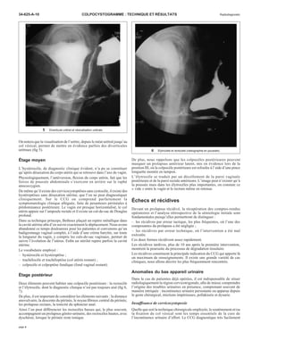 34-625-A-10 COLPOCYSTOGRAMME : TECHNIQUE ET RÉSULTATS Radiodiagnostic 
On notera que la visualisation de l’urètre, depuis le méat urétral jusqu’au 
col vésical, permet de mettre en évidence parfois des diverticules 
urétraux (fig 5). 
Étage moyen 
L’hystérocèle, de diagnostic clinique évident, n’a pu se constituer 
qu’après désaxation du corps utérin qui se retrouve dans l’axe du vagin. 
Physiologiquement, l’antéversion, flexion du corps utérin, fait que les 
forces de poussée abdominale s’exercent en arrière sur le raphé 
anococcygien. 
De même qu’il existe des cervicocystoptôses sans cystocèle, il existe des 
hystéroptôses sans désaxation utérine, que l’on ne peut diagnostiquer 
cliniquement. Sur le CCG on comprend parfaitement la 
symptomatologie clinique alléguée, faite de pesanteurs périnéales à 
prédominance postérieure. Le vagin est presque horizontalisé, le col 
utérin appuie sur l’ampoule rectale et il existe un cul-de-sac de Douglas 
profond. 
Dans sa technique princeps, Bethoux plaçait un repère métallique dans 
la cavité utérine afin d’en suivre exactement le déplacement. Nous avons 
abandonné ce temps douloureux pour les patientes et convenons qu’un 
badigeonnage vaginal complet, à l’aide d’une crème barytée, sur toute 
la longueur du vagin, y compris les culs-de-sac vaginaux, permet de 
suivre l’évolution de l’utérus. Enfin un stérilet repère parfois la cavité 
utérine. 
Le vocabulaire employé : 
– hystérocèle et hystéroptôse ; 
– trachélocèle et trachéloptôse (col utérin restant) ; 
– colpocèle et colpoptôse fundique (fond vaginal restant). 
Étage postérieur 
Deux éléments peuvent habiter une colpocèle postérieure : la rectocèle 
et l’élytrocèle, dont le diagnostic clinique n’est pas toujours aisé (fig 6, 
7). 
De plus, il est important de considérer les éléments suivants : la distance 
anovulvaire, la descente du périnée, le noyau fibreux central du périnée, 
les prolapsus rectaux, la tonicité du sphincter anal. 
Ainsi l’on peut différencier les rectocèles basses qui, le plus souvent, 
accompagnent un prolapsus génito-urinaire, des rectocèles hautes, avec 
dyschésie, lorsque le périnée reste tonique. 
De plus, nous rappelons que les colpocèles postérieures peuvent 
masquer un prolapsus antérieur latent, mis en évidence lors de la 
position III, où la colpocèle postérieure est refoulée à l’aide d’une pince 
longuette montée en tampon. 
L’élytrocèle se traduit par un décollement de la paroi vaginale 
postérieure et de la paroi rectale antérieure. L’image peut n’exister qu’à 
la poussée mais dans les élytrocèles plus importantes, on constate ce 
« vide » entre le vagin et le rectum même en retenue. 
Échecs et récidives 
Devant un prolapsus récidivé, la récupération des comptes-rendus 
opératoires et l’analyse rétrospective de la sémiologie initiale sont 
fondamentales puisqu’elles permettront de distinguer : 
– les récidives par erreur tactique, les plus fréquentes, où l’une des 
composantes du prolapsus a été négligée ; 
– les récidives par erreur technique, où l’intervention a été mal 
exécutée. 
Ces deux formes récidivent assez rapidement. 
Les récidives tardives, plus de 10 ans après la première intervention, 
montrent la poursuite du processus de dégradation tissulaire. 
Les récidives constituent la principale indication du CCG qui apporte là 
un maximum de renseignements. Il existe une grande variété de cas 
cliniques, nous allons décrire les plus fréquemment rencontrés. 
Anomalies du bas appareil urinaire 
Dans le cas de patientes déjà opérées, il est indispensable de situer 
radiologiquement la région cervicotrigonale, afin de mieux comprendre 
l’origine des troubles urinaires en présence, comprenant souvent de 
manière intriquée : incontinence urinaire persistante ou apparue depuis 
le geste chirurgical, mictions impérieuses, pollakiurie et dysurie. 
Insuffisance de cervicocystopexie 
Quelle que soit la technique chirurgicale employée, le soutènement et/ou 
la fixation du col vésical sont les temps essentiels de la cure de 
l’incontinence urinaire d’effort. Le CCG diagnostique très facilement 
5 Diverticule urétral et vésicalisation urétrale. 
6 Élytrocèle et rectocèle (radiographie en poussée). 
page 4 
 