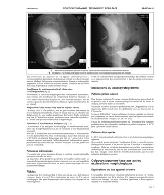Radiodiagnostic COLPOCYSTOGRAMME : TECHNIQUE ET RÉSULTATS 34-625-A-10 
7 Rectocèle et hystéroptôse périnéale moyenne, col vésical fixé et base vésicale insuffisamment épaulée. 
8 Persistance d’un prolapsus de l’étage moyen et postérieur après cervicocystopexie (radiographie en poussée). 
des anomalies de position de la région cervicotrigonale : 
cervicocystoptôse persistante, vésicalisation urétrale avec base vésicale 
souvent très haut fixée par une promontofixation. Lors de la radiographie 
en poussée, la fuite urinaire est souvent patente, visualisée par la baisse 
du niveau de produit de contraste intravésical. 
Insuffisance de soutènement vésical (distorsions 
cervicotrigonales) (fig 7) 
Inversement, la cervicocystopexie peut être correctement positionnée, 
mais il existe une insuffisance de soutènement de la base vésicale. Le 
CCG montre une récidive de cystocèle, plus ou moins marquée, lors du 
cliché en poussée (position II) et une fixation rigide rétropubienne du 
col vésical. 
Malposition d’une fronde (trop haut ou trop bas située) 
La fronde (ou « l’effet fronde ») peut ne pas être située exactement au 
niveau de la jonction urétrale. Si elle est placée trop bas, on observe lors 
de la position II, une coudure postérieure de l’urètre. Si elle est placée 
trop haut, à l’aplomb du trigone, on objective une « encoche trigonale », 
et l’urètre sous-jacent est verticalisé et hypotonique. 
Persistance d’un élément de prolapsus (fig 7, 8) 
La persistance d’un prolapsus utérin négligé ou insuffisamment traité, 
après cure d’un prolapsus vésical, en est l’exemple le plus fréquemment 
rencontré. 
Bien sûr, il faudra faire une confrontation anatomique et fonctionnelle 
avec les paramètres d’un bilan urodynamique, mais il faut préciser que 
le CCG est un examen dynamique qui met en évidence des fuites 
urinaires patentes au cours de l’effort de poussée abdominale et montre 
parfaitement la contraction des muscles releveurs, s’ils ont gardé leur 
pouvoir contractile. 
Prolapsus démasqués 
L’exemple type est un prolapsus de tout le combiné viscéral où seul le 
prolapsus vésical a été traité. 
La majoration d’un prolapsus postérieur (rectocèle ou élytrocèle) se 
rencontre fréquemment après cervicocystopexie avec ou sans bandelette 
antérieure et promontofixation ou après cervicocystopexie avec 
hystérectomie (fig 6). 
Fistules 
Le diagnostic des fistules est fait, le plus souvent, au cours de l’examen 
clinique, mais il peut l’être également au cours de l’examen 
radiologique. On peut diagnostiquer des fistules vésicovaginales ou 
urétrovaginales. 
Enfin, on peut rencontrer un aspect totalement figé du combiné viscéral 
avec superposition des positions I et II par des actes chirurgicaux 
réitérés. 
Indications du colpocystogramme 
Patiente jamais opérée 
Il ne fait que confirmer l’examen clinique du chirurgien, permettant de 
ne passer à côté d’aucun élément masqué ou atténué et de traiter la 
statique pelvienne dans son ensemble. 
Devant un prolapsus postérieur prédominant, le CCG permet de faire le 
diagnostic différentiel entre les différents types de rectocèles et 
l’élytrocèle. 
En cas de difficulté de l’examen clinique, étroitesse vaginale ou patiente 
peu coopérante, ou en cas de discordance entre les signes fonctionnels 
et les constatations cliniques, le CCG est utile. 
En cas de prolapsus posthystérectomie où l’inventaire des éléments 
prolabés dans une colpoptôse fundique est parfois trompeur, le CCG 
peut également rendre service. 
Patiente déjà opérée 
LeCCGmet en lumière les éléments fixés et les distorsions anatomiques 
apparues. 
Il permet de poser au mieux l’indication d’une éventuelle reprise 
chirurgicale et surtout d’en prévoir la voie d’abord et la technique à 
employer. Mais les récidives demandent une parfaite confrontation 
anatomique et fonctionnelle, et l’on doit se souvenir que l’on ne traite 
pas des « images » mais bien des troubles fonctionnels, qu’ils soient 
urinaires, génitaux ou rectaux. 
Colpocystogramme face aux autres 
explorations morphologiques 
Explorations du bas appareil urinaire 
L’urographie intraveineuse visualise parfaitement la vessie et l’urètre, 
mais uniquement lors de la miction. Cet examen nous paraît surtout 
intéressant lorsque l’on veut visualiser également le haut appareil 
urinaire et le trajet des uretères. 
7 
8 
page 5 
 