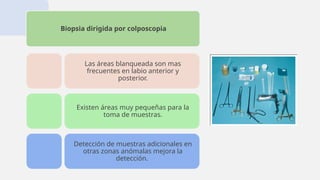 Biopsia dirigida por colposcopia
Las áreas blanqueada son mas
frecuentes en labio anterior y
posterior.
Existen áreas muy pequeñas para la
toma de muestras.
Detección de muestras adicionales en
otras zonas anómalas mejora la
detección.
 