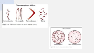 Colposcopia GENERALIDADES DEL TEMA......