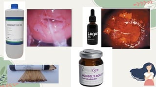 Comprehensive Guide to Colposcopy: Instruments, Techniques, and ...