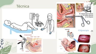 Comprehensive Guide to Colposcopy: Instruments, Techniques, and ...
