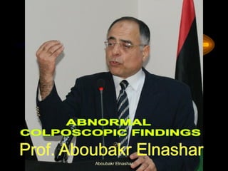 Aboubakr Elnashar
 