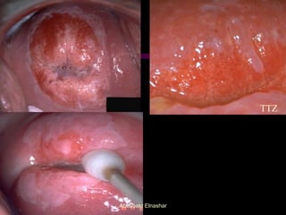 TTZ
Aboubakr Elnashar
 