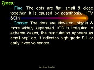 Types:
. Fine: The dots are flat, small & close
together. It is caused by acanthosis, HPV
&CINI
. Coarse: The dots are elevated, bigger &
more widely separated. ICD is irregular. In
extreme cases, the puncutation appears as
small papillae. It indicates high-grade SIL or
early invasive cancer.
Aboubakr Elnashar
 