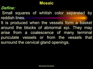 Mosaic
Define:
Small squares of whitish color separated by
reddish lines.
It is produced when the vessels form a basket
around the blocks of abnormal epi. They may
arise from a coalescence of many terminal
puncutate vessels or from the vessels that
surround the cervical gland openings.
Aboubakr Elnashar
 