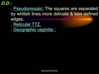 D.D.:
. Pseudomosaic: The squares are separated
by whitish lines more delicate & less defined
edges.
. Reticular TTZ.
. Geographic vaginitis :
Aboubakr Elnashar
 